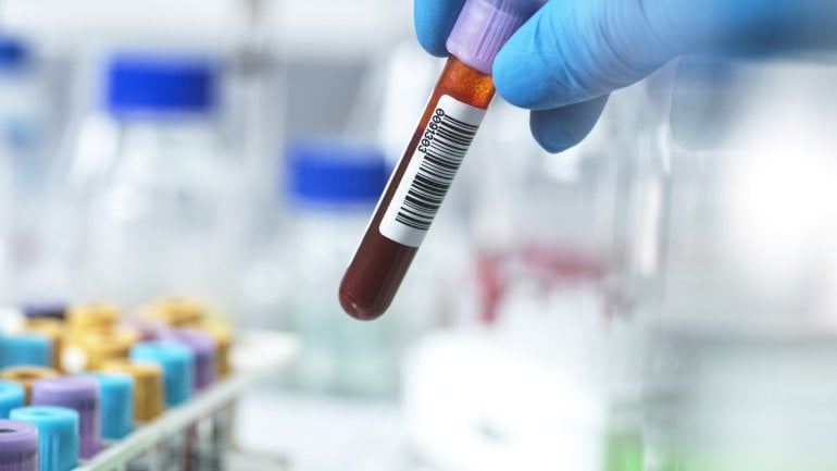 Ärztliches Personal hält eine Blutprobe in der Hand, um den Thrombozyten-Wert zu bestimmen.