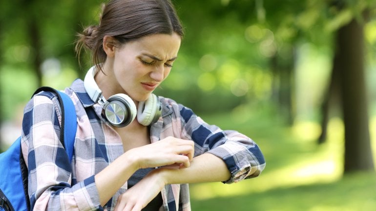 Nesselsucht durch Kontakt mit Allergenen