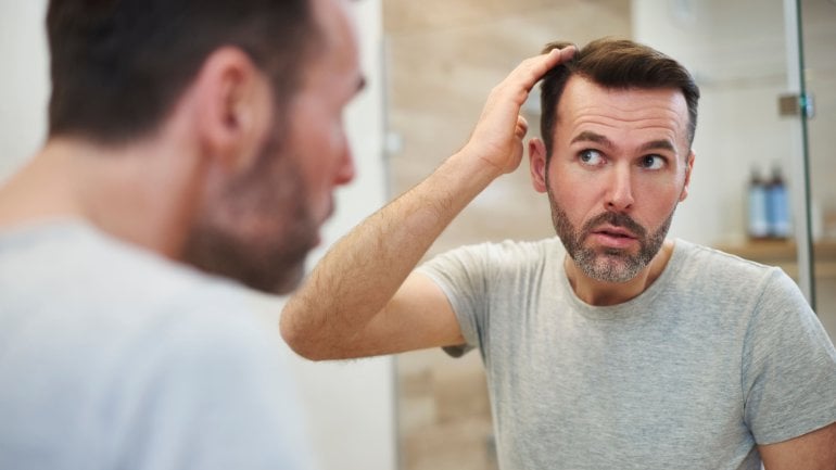 Junger Mann mit diffusem Haarausfall vor dem Spiegel