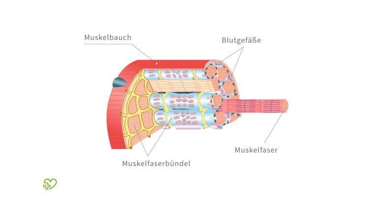 Verschiedene Formen von Hämatomen 