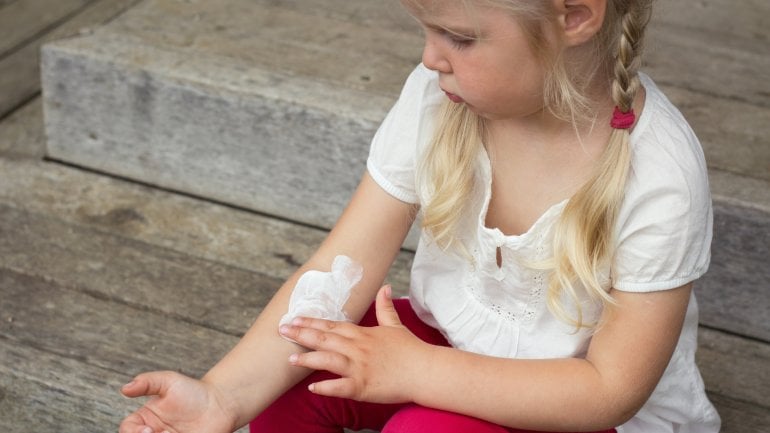 Neurodermitis bei Kindern