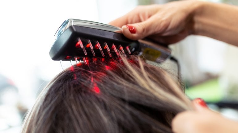 Mittel gegen Haarausfall: Lasertherapie