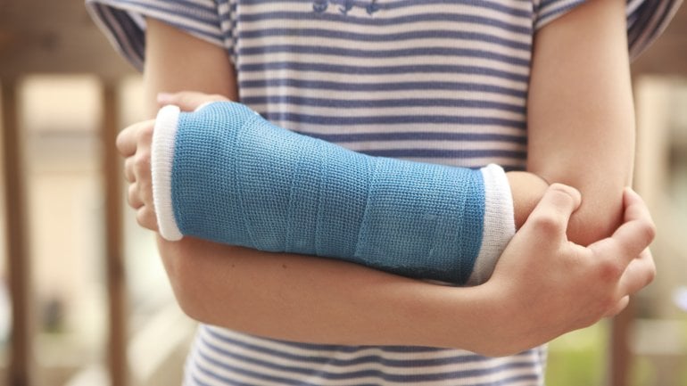 Glasknochenkrankheit: Bild eines Kindes mit gebrochenem Arm mit Gipsverband. 