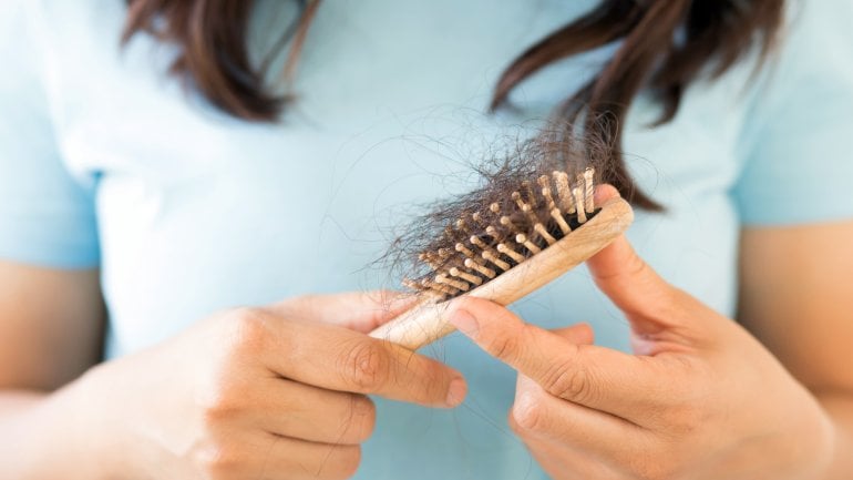 Frau mit Brüste leidet an Haarausfall.