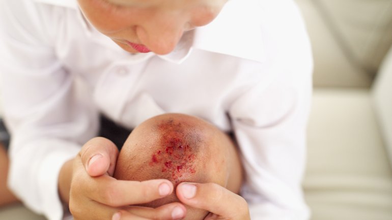 Das Bild zeigt einen Jungen mit verletztem Knie.