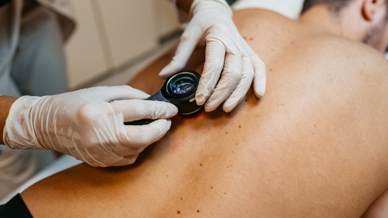 Eine Hautärztin untersucht den Rücken eines Mannes auf Hautkrebs hin