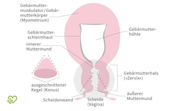 Konisation (Therapieverfahren) bei Gebärmutterhalskrebs | © © Onmeda