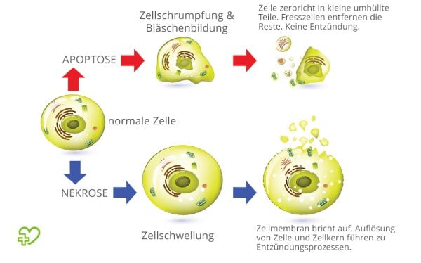 Modell der Abläufe bei Apoptose und Nekrose | © © Onmeda