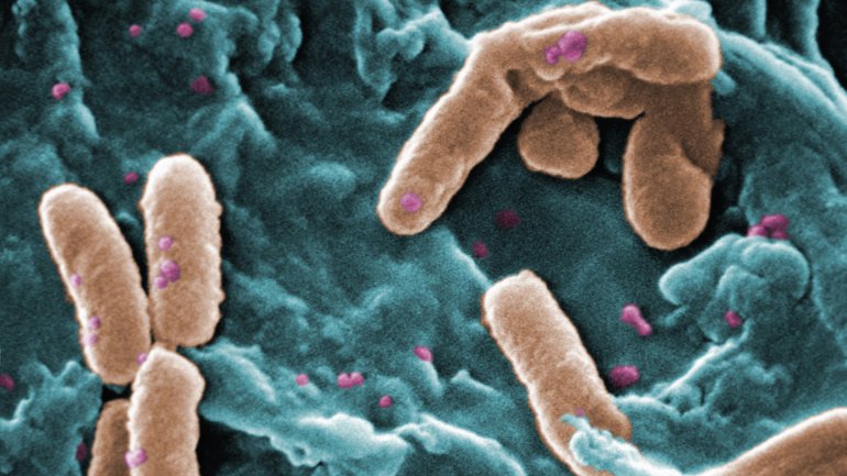 Man sieht eine Aufnahme der Baktierienart Pseudomonas aeruginosa mit dem Rasterelektronenmikroskop (REM).